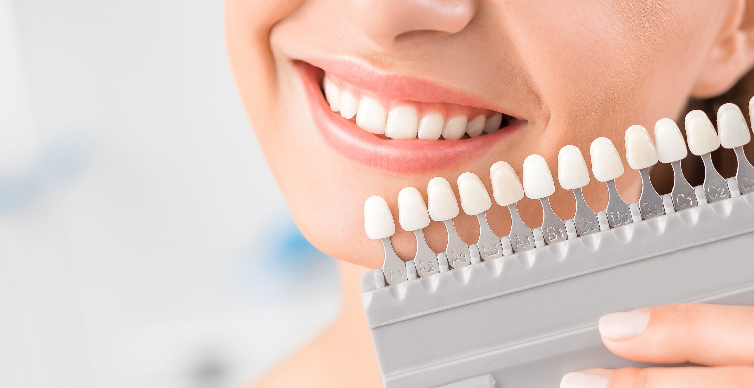 In-Office Teeth Whitening