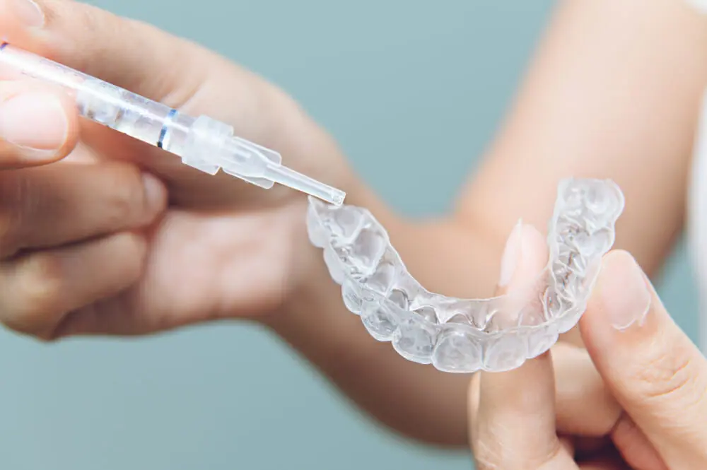 At-Home Teeth Whitening